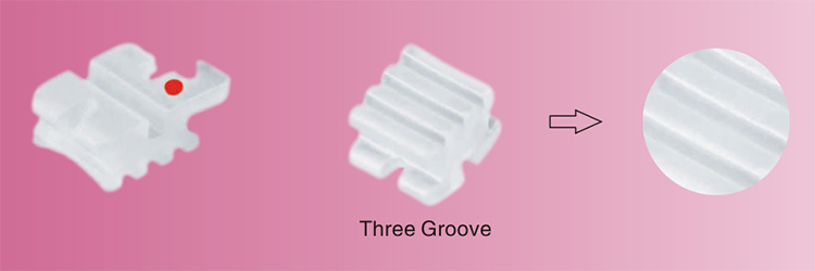 OR2011 Ceramic Brackets